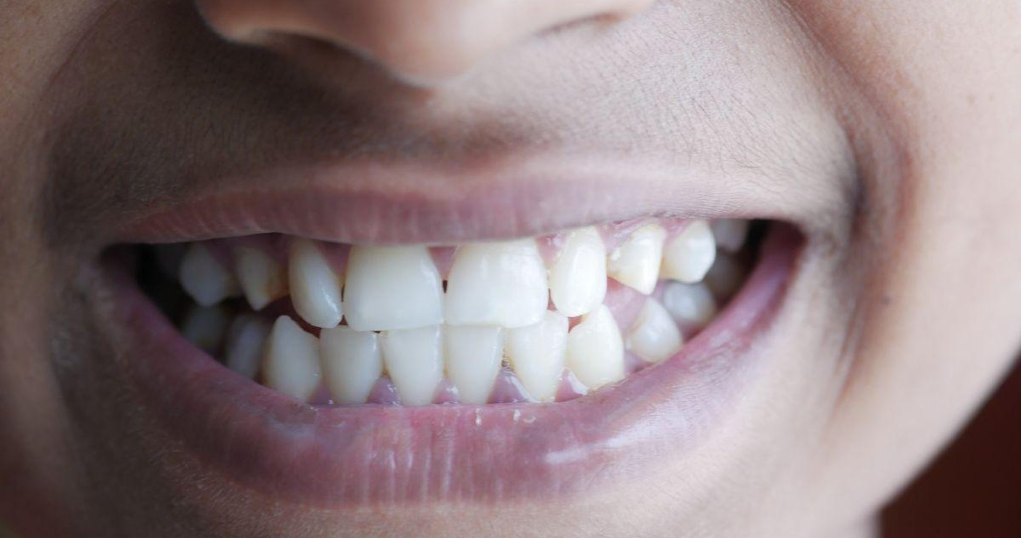 Close-up image of a person with a bright, healthy smile showcasing clean teeth, representing quality dental care